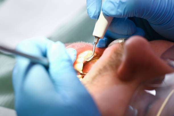 Best Emergency Dental Care for Sports Injuries in Pineland, TX