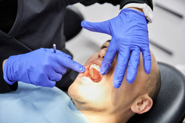 Best Emergency Wisdom Tooth Extraction in Pineland, TX